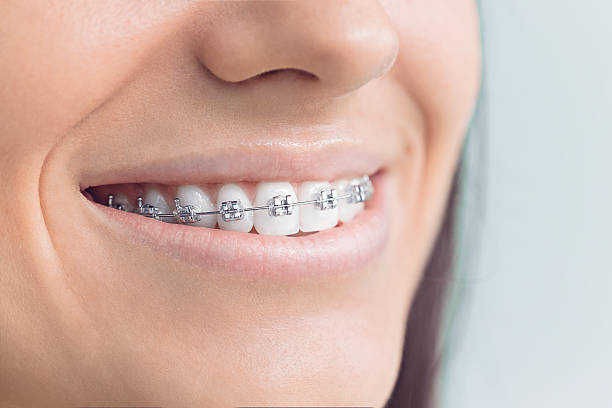 Best Tooth Extraction  in Pquemine, LA